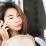 cam-nang-dieu-tri-nep-nhan-4