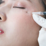 cam-nang-dieu-tri-nep-nhan-5