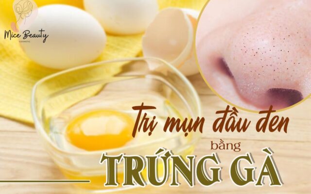Trị mụn đầu đen bằng trứng gà, oliu & mật ong